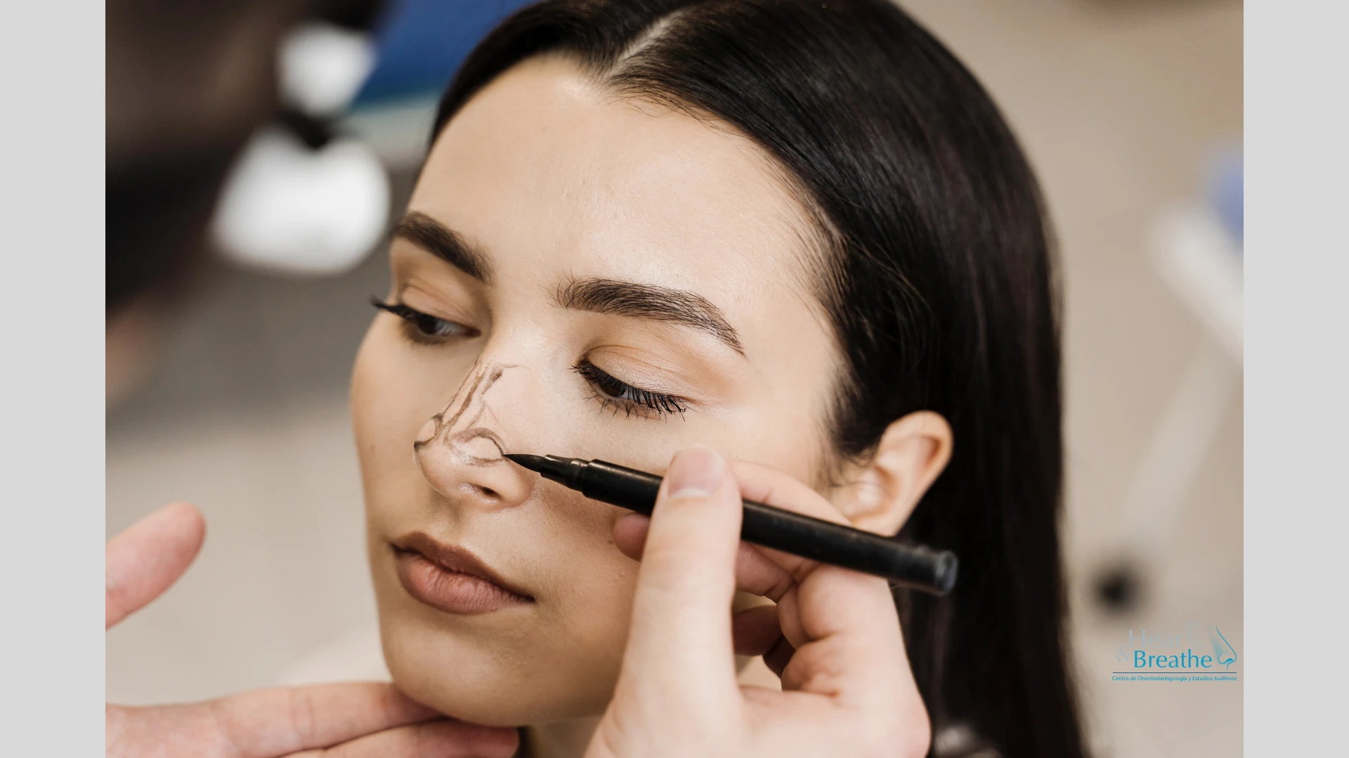 Rinoplastia 2 rinoplastia en cancun