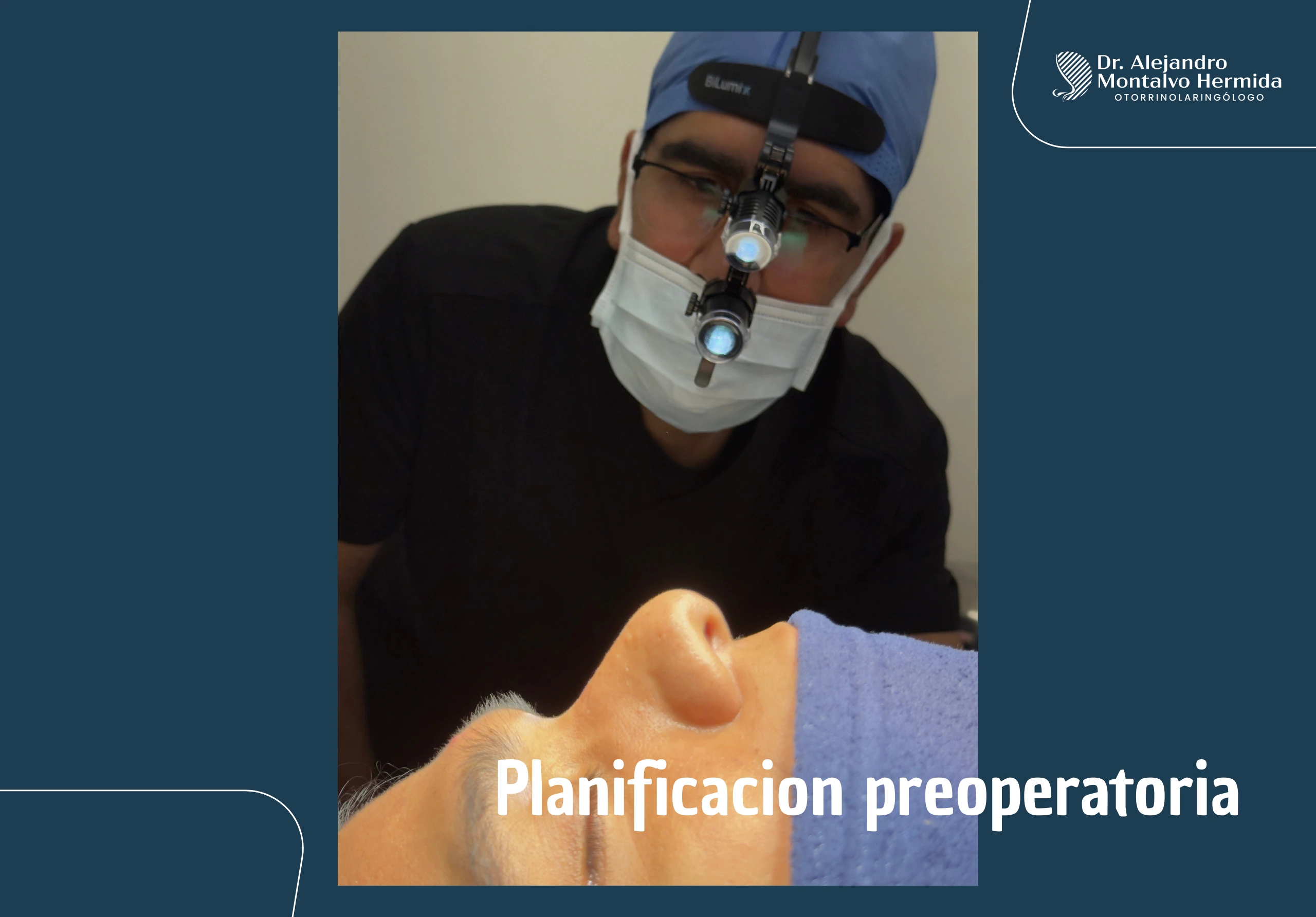 Rinoplastia 2 dr-montalvo-cirugia-nasal-rinoplastia